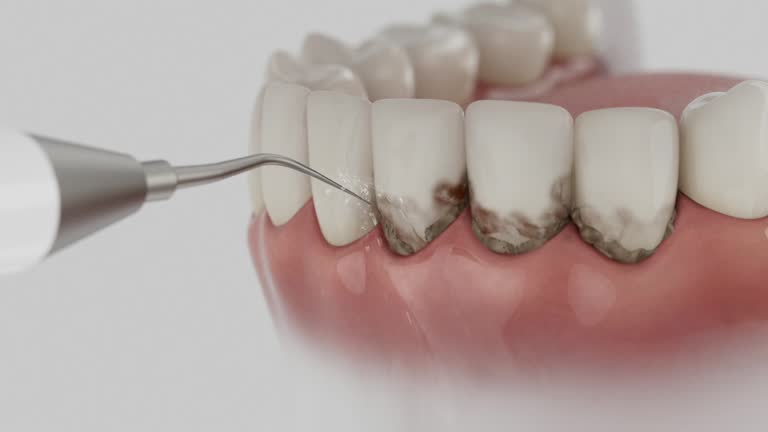 Reliable Dental Implants contractor in Owatonna, MN by Smile Center Dentistry